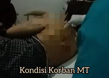 Sadis! Bupati Dogiyai Diduga Menikam Istrinya Sendiri