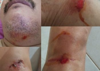 Tidak Bertanggung Jawab atas sebuah Insiden , Kepala Cabang Telkom WiFi Barru Minta Dicopot