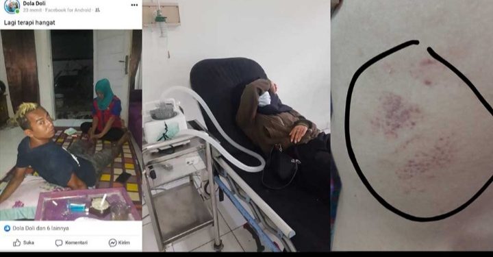 Diduga Akibat Masalah Sepele, Karyawan Perusahaan Tambang di Sukabumi Aniaya Seorang Wanita