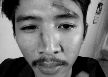 Setiap Warga Negara Berhak Menggugat Penguasa Yang Lalai Pelihara Sarana Jalan Sehingga Mencelakai Dirinya