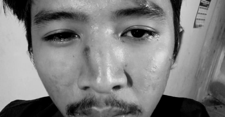 Setiap Warga Negara Berhak Menggugat Penguasa Yang Lalai Pelihara Sarana Jalan Sehingga Mencelakai Dirinya